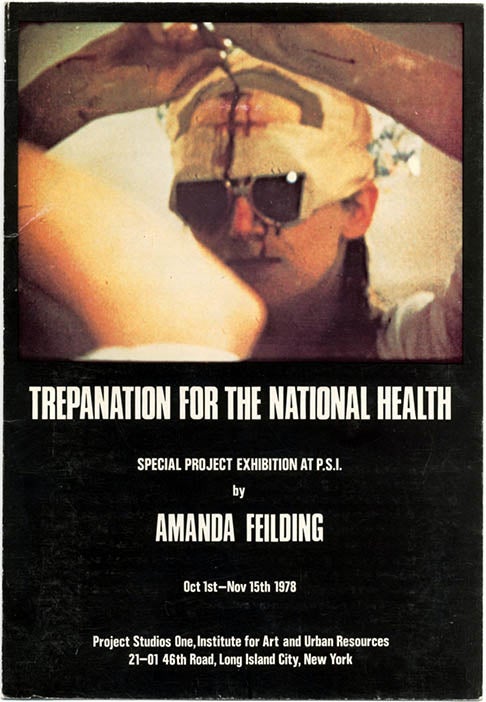Item #39563 Trepanation for the National Health. Special Project Exhibition at P.S.I. Amanda FEILDING.